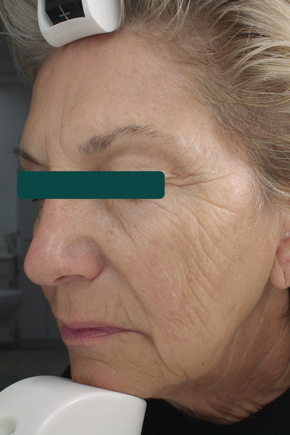 Anti-Aging Retinol