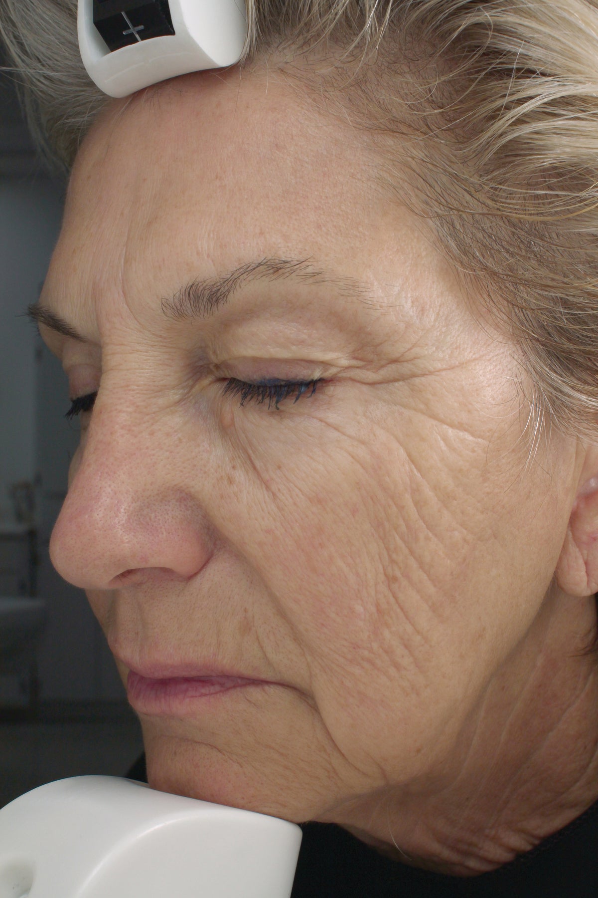 Anti-Aging Retinol