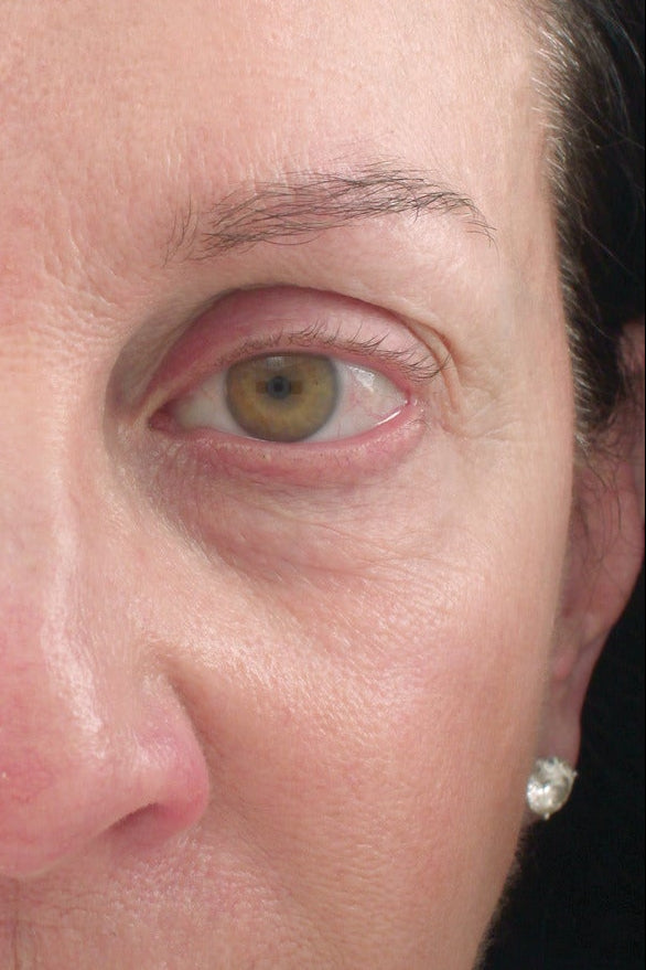 Close-up of a woman's face with a device on her forehead against a black background