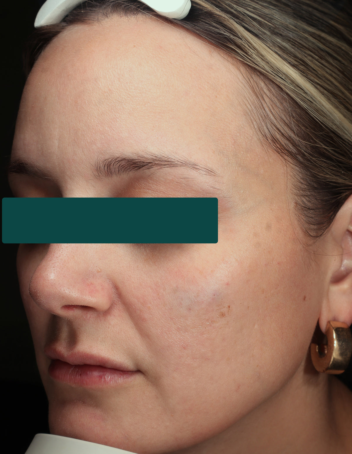 Glass-Smooth Skin