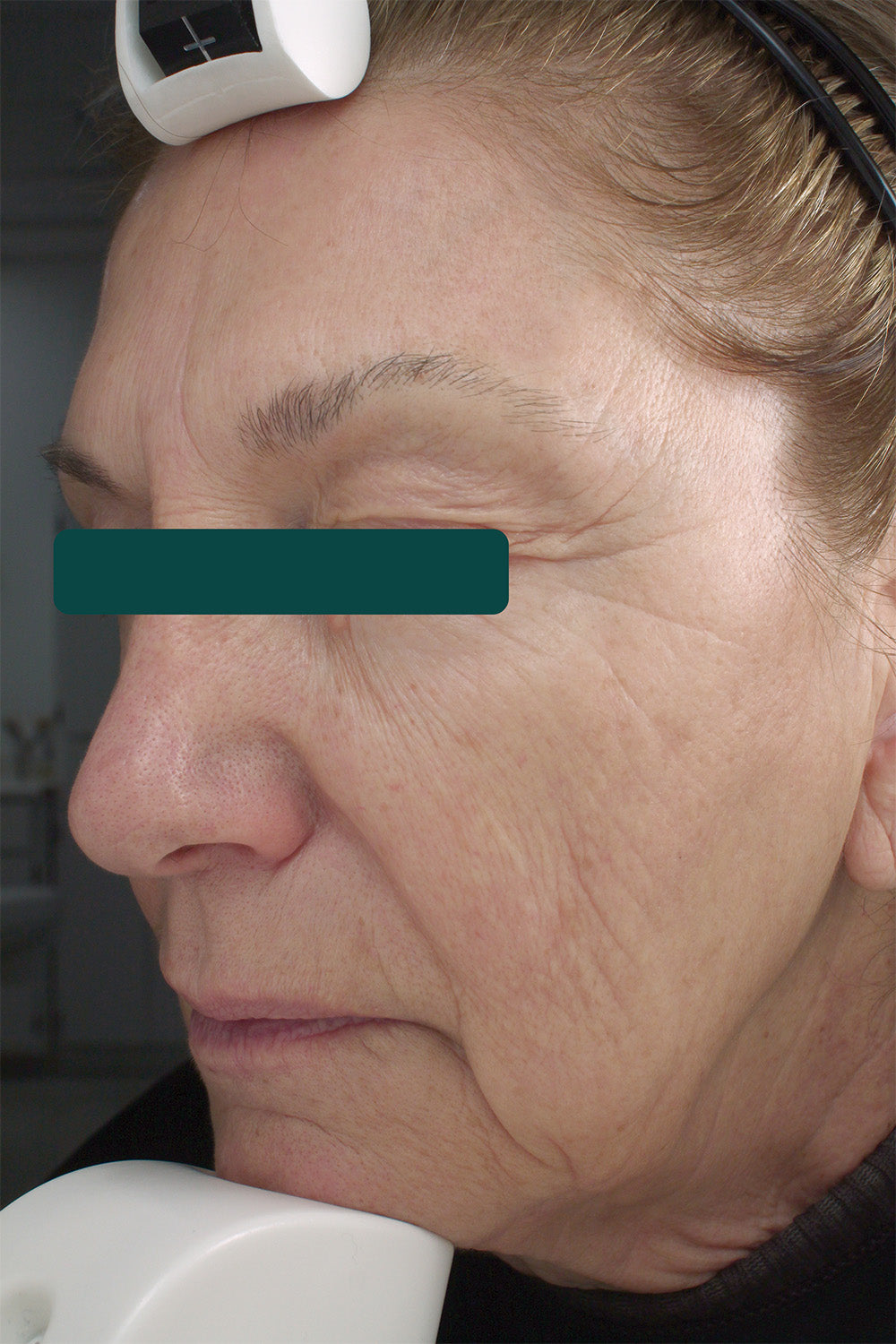 Anti-Aging Retinol