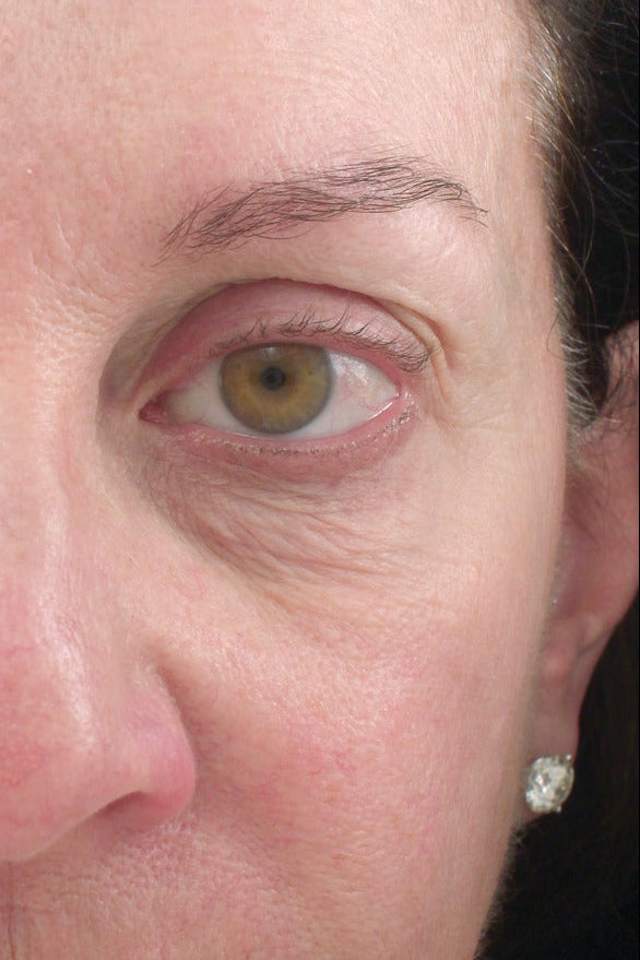 Close-up of a woman's face with a device on her forehead against a black background