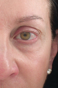 Close-up of a woman's face with a device on her forehead against a black background