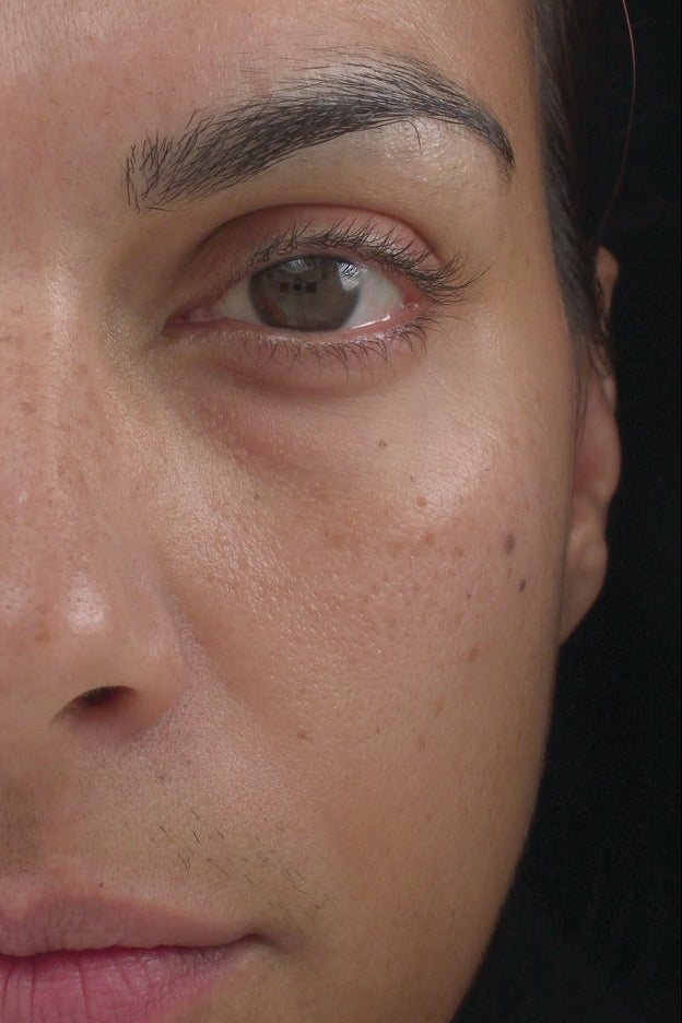 Marini Luminate® Eye Gel | Brighten Under Eye Circles & Eye Bags