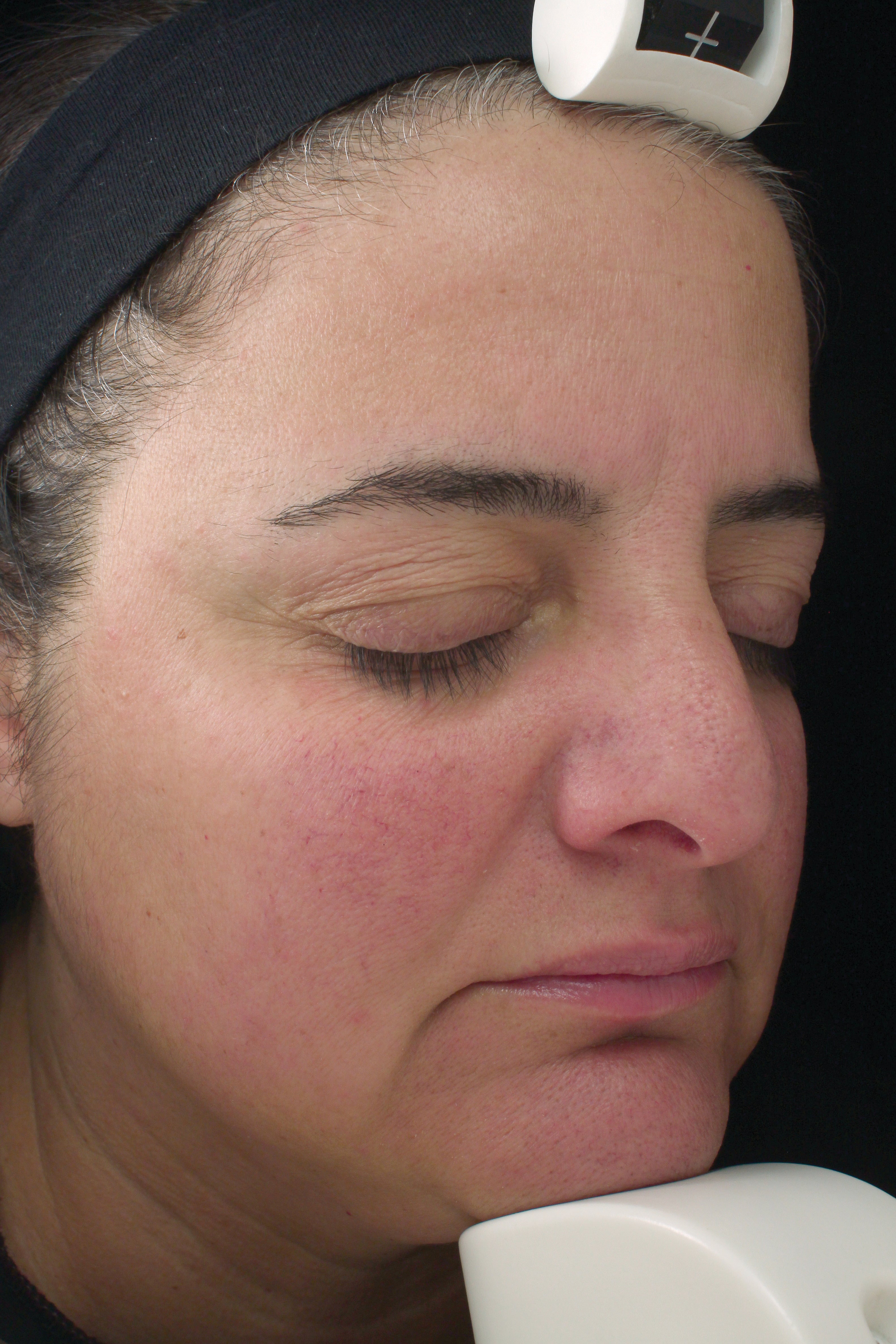 RosaLieve® Redness Reducing Complex – Marini SkinSolutions