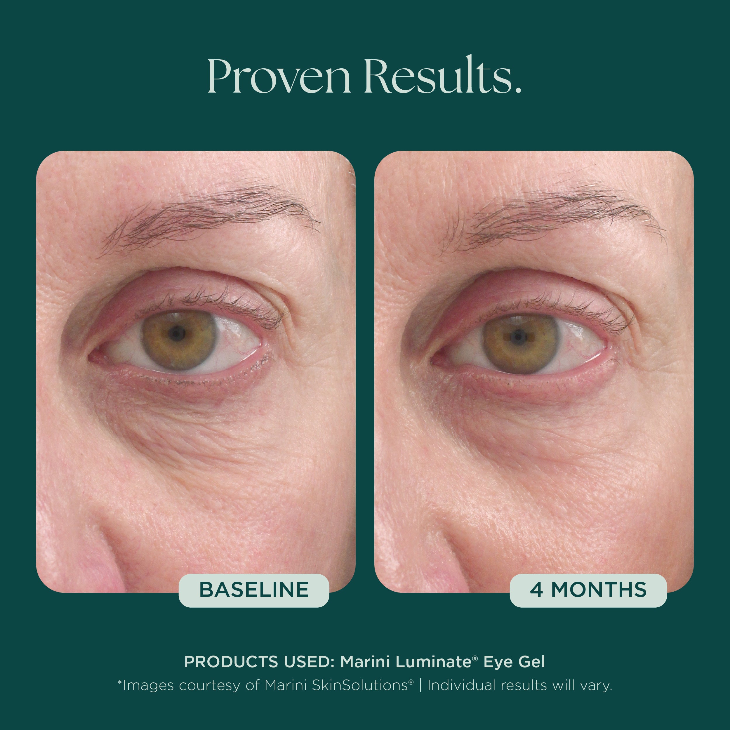 Marini Luminate® Eye Gel | Brighten Under Eye Circles & Eye Bags