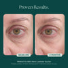Before and after comparison of eye area with text indicating 'Proven Results' and '4 Months' using Marini Luminate Eye Gel. Clinical grade skin care with proven results and Before & After photos.