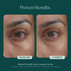 Before and after comparison of eye gel treatment with visible reduction of dark circles under eyes, eye bags, and eye wrinkles. Medical grade skin care used: Marini Luminate Eye Gel from Marini SkinSolutions