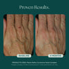 Before and After Photo Results of Anti-Aging Hand Treatment. Clinically proven skin care for hand wrinkles, hand discoloration, and hand aging. Product used: Marini ReNu Corrective Hand Complex from Marini SkinSolutions