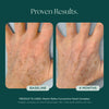 Before and After Photo Results of Anti-Aging Hand Treatment. Clinically proven skin care for hand wrinkles, hand discoloration, and hand aging. Product used: Marini ReNu Corrective Hand Complex from Marini SkinSolutions