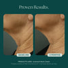 Before and after comparison of neck skin texture with Juveneck Neck Cream from Marini SkinSolutions, showing visible improvement over 3 months.