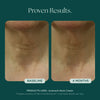 Before and after comparison of neck skin with Juveneck Neck Cream from Marini SkinSolutions. Reduce the appearance of neck wrinkles and neck skin laxity with proven clinical results.