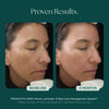 Before and After photo comparison using medical grade skin care Marini Luminate from Marini SkinSolutions. This anti-aging face serum is proven for those with discoloration, dark spots, sun spots, hyperpigmentation.