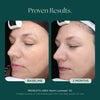 Before and After photo comparison using medical grade skin care Marini Luminate from Marini SkinSolutions. This anti-aging face serum is proven for those with discoloration, dark spots, sun spots, hyperpigmentation.