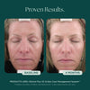 Before and after comparison of a woman's face indicating 4 months of proven clinical results of using Retinol Plus face cream from Marini SkinSolutions.