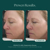 Before and after comparison of a woman's face with text indicating 'Proven Results' and '4 Months' with consistent use of Regeneration Booster, a patented and proven anti-aging face serum from Marini SkinSolutions.