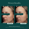 Before and after comparison of a woman's face with only 2 months to show visible proven results. She used NeuroSmooth glass skin face serum by Marini SkinSolutions.