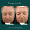 Before and after comparison of a man's face after using medical grade skin care from Marini SkinSolutions. His anti-aging results were from 3 months of the patented and clinically proven Regeneration Booster face serum.