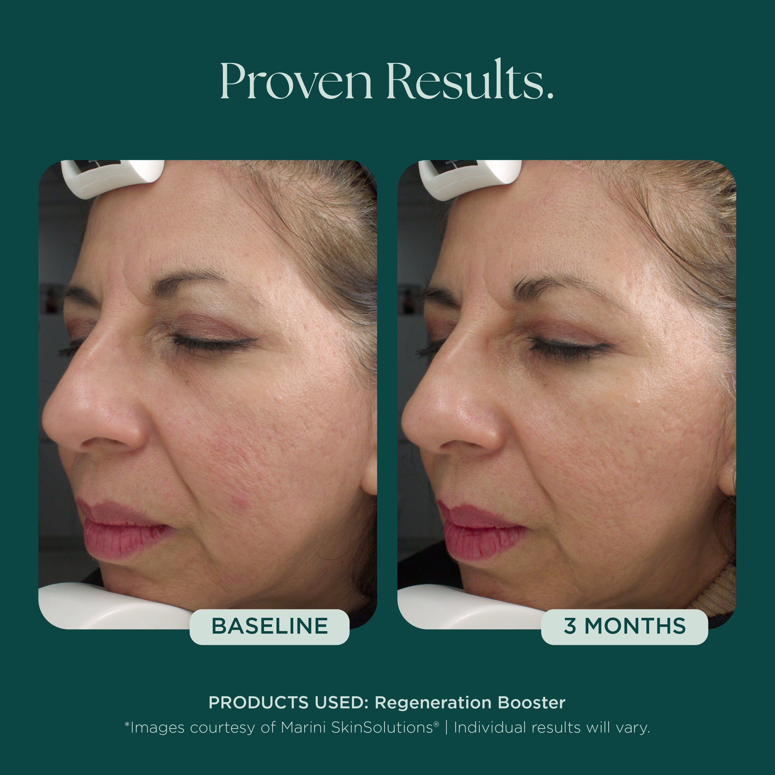 Regeneration Booster | Anti-Aging Peptides & Growth Factors Face