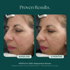 Before and after comparison of a woman's face with visible results of anti-aging and skin quality in 3 months using Regeneration Booster face serum from Marini SkinSolutions.