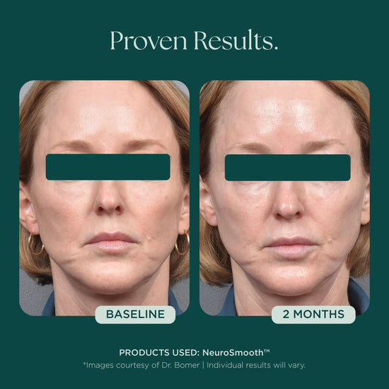 Before and after comparison of a woman's face showing visible glass skin and smooth complexion using Marini SkinSolutions NeuroSmooth Face Serum.