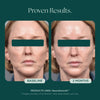 Before and after comparison of a woman's face showing visible glass skin and smooth complexion using Marini SkinSolutions NeuroSmooth Face Serum.
