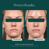 Before and after comparison of a woman's face with 'NeuroSmooth' product, showing 'Baseline' and '2 Months' results. NeuroSmooth is a neruromodulating peptide face serum for glass smooth skin.