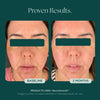 Before and after comparison of a glass skin clinical study showing visible and proven results. The patient used NeuroSmooth, an award-winning face serum for glass smooth skin.