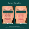 Before and after comparison of a woman's face with 'NeuroSmooth' face serum, an award-winning anti-aging skin care product by Marini SkinSolutions.