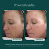 Retinol Plus skin care before and after showing results in as little as 1 month. Twice awarded Best Retinol Cream by NewBeauty Magazine! Marini SkinSolutions retinol face cream blends potent retinol and peptides with green tea extract, chrysin, bisabolol, and hyaluronic acid for unparalleled results and satisfaction.