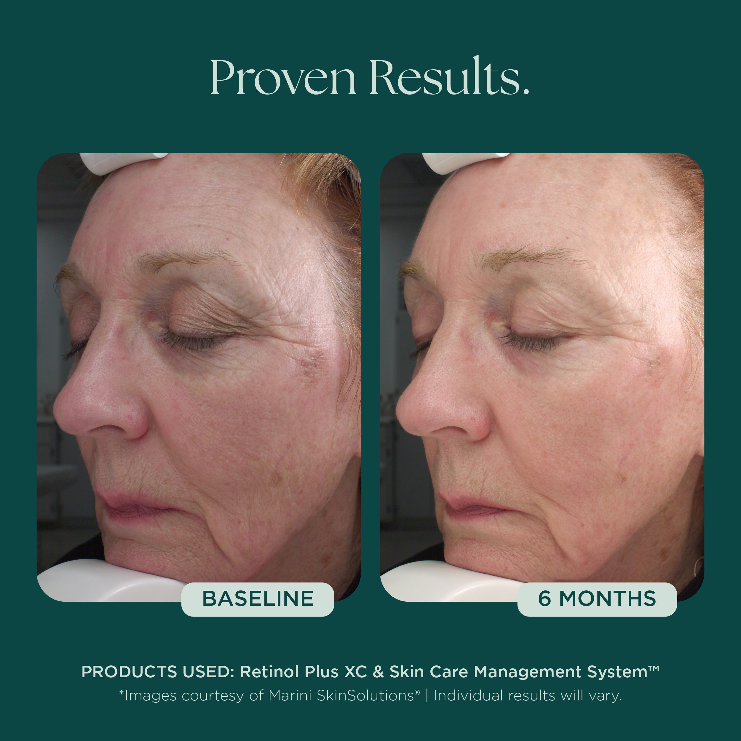 Retinol Plus | Award-Winning Anti-Aging Face Cream with Retinol
