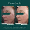 Retinol Plus