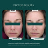 Proven results of RosaLieve Redness Reducing Complex face cream from Marini SkinSolutions. Clinical study with before and after photo showing visible reduction in facial redness.