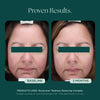 Proven results of RosaLieve Redness Reducing Complex face cream from Marini SkinSolutions. Clinical study with before and after photo showing visible reduction in facial redness.