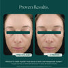 Hyla3D® Face Serum Hyaluronic Acid Complex