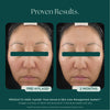 Hyla3D® Face Serum Hyaluronic Acid Complex