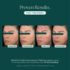 Marini Reboot® PDRN Face Serum