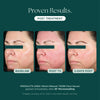 Marini Reboot® PDRN Face Serum