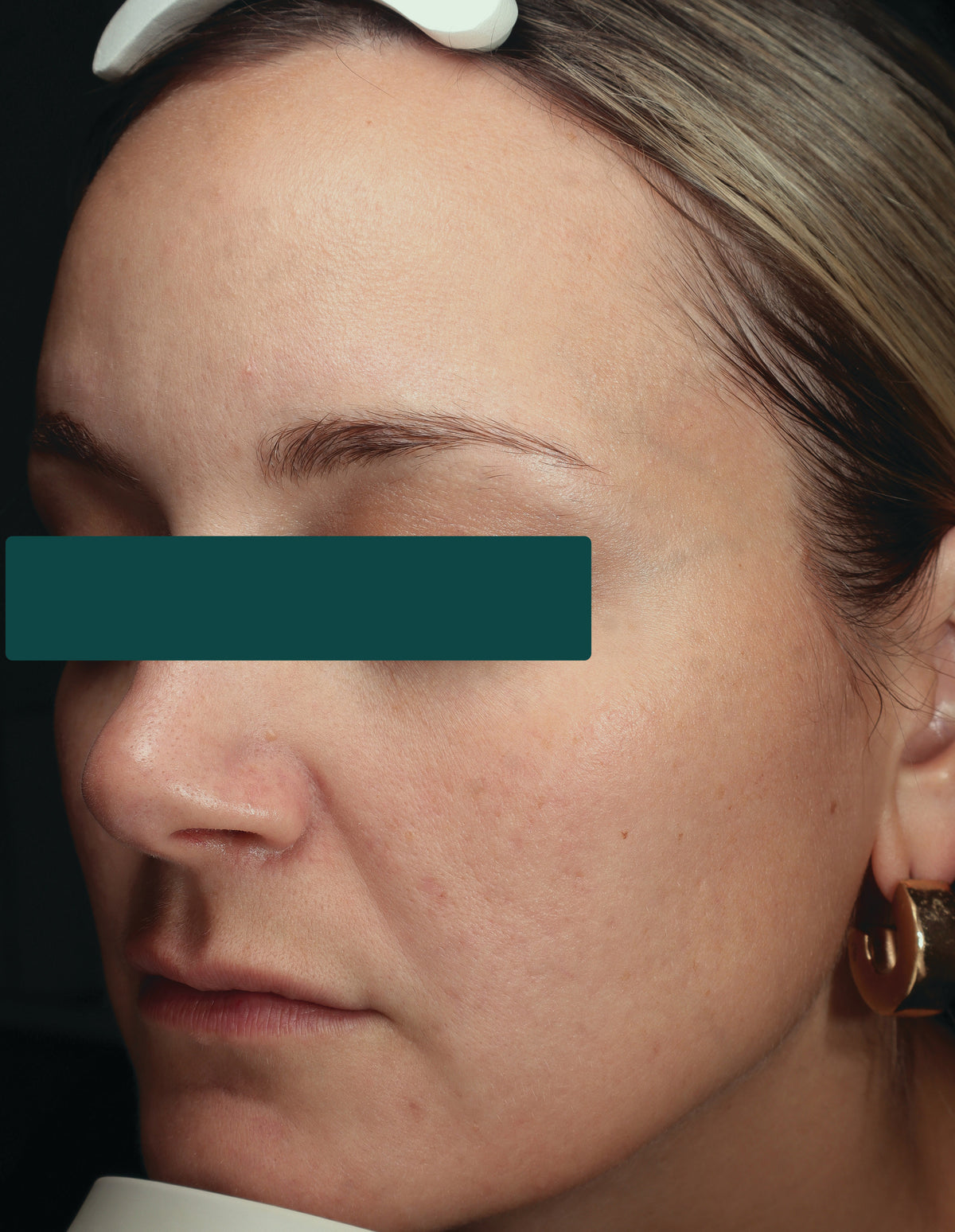 Glass-Smooth Skin
